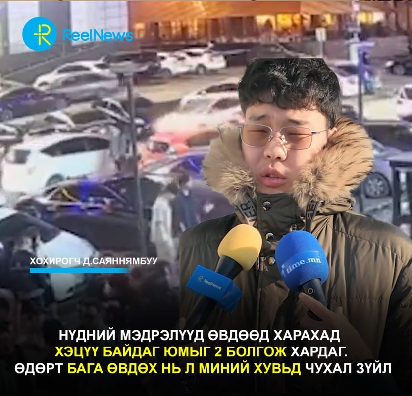 Д.Саяннямбуу: Нүдний мэдрэлүүд өвдөөд харахад хэцүү байдаг юмыг 2 болгож хардаг. Өдөрт бага өвдөх нь л миний хувьд чухал зүйл